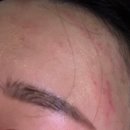 강동-천호-309 | [Review] 강동구 피부관리 고은결에스테틱 "트러블 비립종 관리" 후기