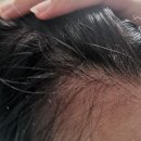 정화옷수선 | 두피 가려움 원인 예방 및 해결 샴푸 하나면 잘 고르면 돼요