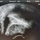 소문난비뇨의학과의원 이미지