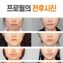 프로필성형외과의원
