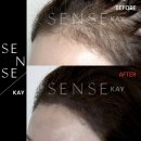 리더 헤어라인 | 워터파크•수영장•바다•해수욕장•워터밤 가기 전 꼭 보세요, 헤어라인 고민 이유🤔