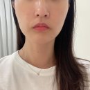 예올한의원 | 병점 피부관리 예올린 에스테틱_피부과시술 후 탁월한 재생관리