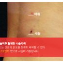 하피스의원 네이버블로그
