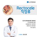 부산제2항운병원 | [의학정보] Rectocele 직장류 / 부산제2항운병원 황성환 대표원장