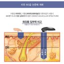 엔블리