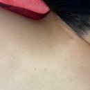 올바른뷰티 - 세종특별자치시 | 진접바디필링 잘하는 곳 올바른뷰티 등필링 후기