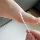 제일성광유치원 | 수족구 유행시기, 초기증상·잠복기·전염과 후기 정리