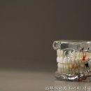 따뜻한인치과의원 | 서울치과 따뜻한인치과의원 서울대 관악구 점 걱정 없던 치료