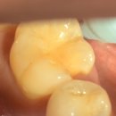 레몬치과의원 이미지