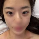 호텔보다 | 중흥동 피부관리 트리엘에스테틱 물방울리프팅 완전 만족한 후기