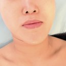 풀려 바디관리 | 당진 얼굴관리 추천, 리프레쉬 스킨&바디에서 피부관리 받고 온 솔직후기