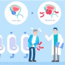헷갈리기 쉬운 과민성 방광 vs 전립선비대증 이미지