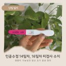 수정-16 | 인공수정 1차 성공 14일차 16일차 피검사 hCG 수치 후기, 쌍둥이 가능성과 임신초기증상 정리