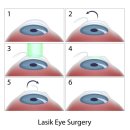 눈에미소안경원 이미지
