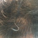 (주)유바이오메드 이미지