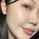 프리미업 | 강남역피부과 피코토닝 대신 색소레이저 프리미엄 후기(기미, 색소침착 루카스토닝, 클라리티)