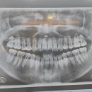 올디플란트치과의원 이미지