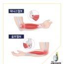 단 한 번도 테니스를 쳐본 적 없는데 테니스엘보라고? 테니스/골프 엘보 이미지