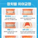 명성치과기공소 이미지