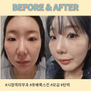 을지입구지하쇼핑센터 | [을지로입구역피부과] 쥬베룩스킨으로 모공 탄력 고민해결, 애플존 채운 후기