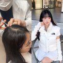 아르케에이 | 여자 앞머리 탈모, 잠실 여성 두피 보톡스 시술 후기!(아르케 MTS 4~5차)