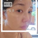 스피드메이트 영종하늘도시점 | 영종피부샵 하늘도시 라라필 바이쏭 관리 후기