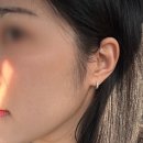 루비의원 | 압구정 루나의원 루비레이저 예약 가격 효과 한달 후기