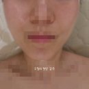 춘천피부관리 지엔뷰티 수분관리