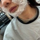 용산-400 | 용산피부과 내돈내산 리니어지 400샷 리프팅 일주일 찐 후기(팔자, 불독살, 턱라인)