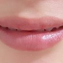 누브의원 이미지