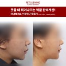 리터닝성형외과의원