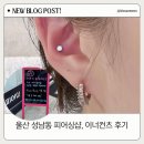 오피어싱 | 울산 성남동 오피어싱 – 이너컨츠 시술 과정과 관리법