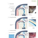 YES한방병원 | [서면 도수치료] 어깨가 얼어붙은 것처럼 아픈 이유? ‘유착성 관절낭염(오십견)’ 완전 정리