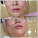 황후피부관리실 | [안산 중앙동] 피부톤업+윤곽관리까지 원샷으로 해결! 안산 🧖‍♀️황후💎 피부관리 솔직후기