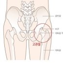 퇴행성 관절-통증 치료 (프롤로 치료) 이미지