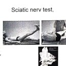 (nerve test)Sciatic nerve test 이미지