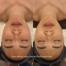 대아메디칼 | 가양 피부관리 올가드림뷰티 강서가양점에서 디톡스 관리 후기