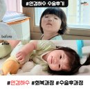 노란케어119 | 아기 안검하수 수술 후기 | 안검하수 수술 후 2주간의 회복 과정 기록