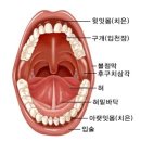 구강암 (Oral Cavity Cancer) 이미지