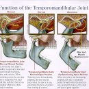 턱관절교정(TMJ (Temporomandibular Joint Disorder))2 이미지