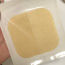 새희망약국 | 편평사마귀 제거 비립종 200개 레이저 지진후기 (혐짤주의)