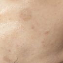 꽃빛한방병원 | 대전꽃빛한방병원