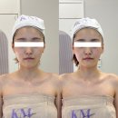 불당동 윤곽관리 추천 케이엠 에스테틱