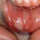 화통한의원 이미지