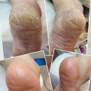 푸스케어 용인역북점