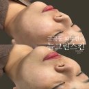 늘그린스킨