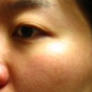 스킨트리 이미지