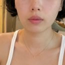 에이피부과 | 이오에이(EOA) 풀써마 후기｜6.78MHz 고주파 효과 있을까? 모공·속건조 탄력까지 장단 분석