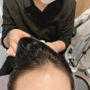 유진덴탈 | 부산 남구 두피관리 경성대 웰킨 꼼꼼한 분석과 정수리 케어 후기