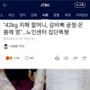 "42kg 치매 할머니, 갈비뼈 골절·온몸에 멍"…노인센터 집단폭행 이미지